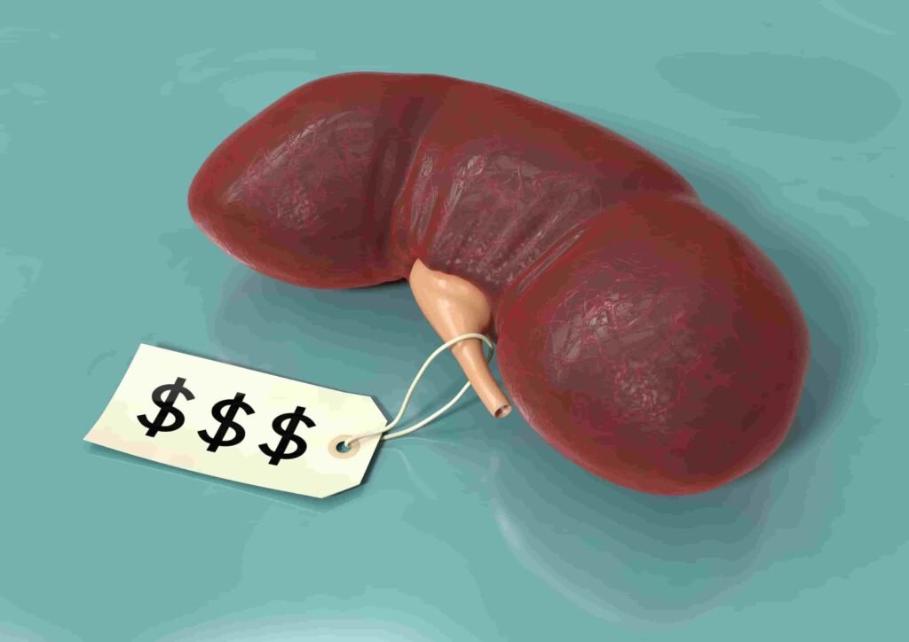 Can You Sell Your Kidney?